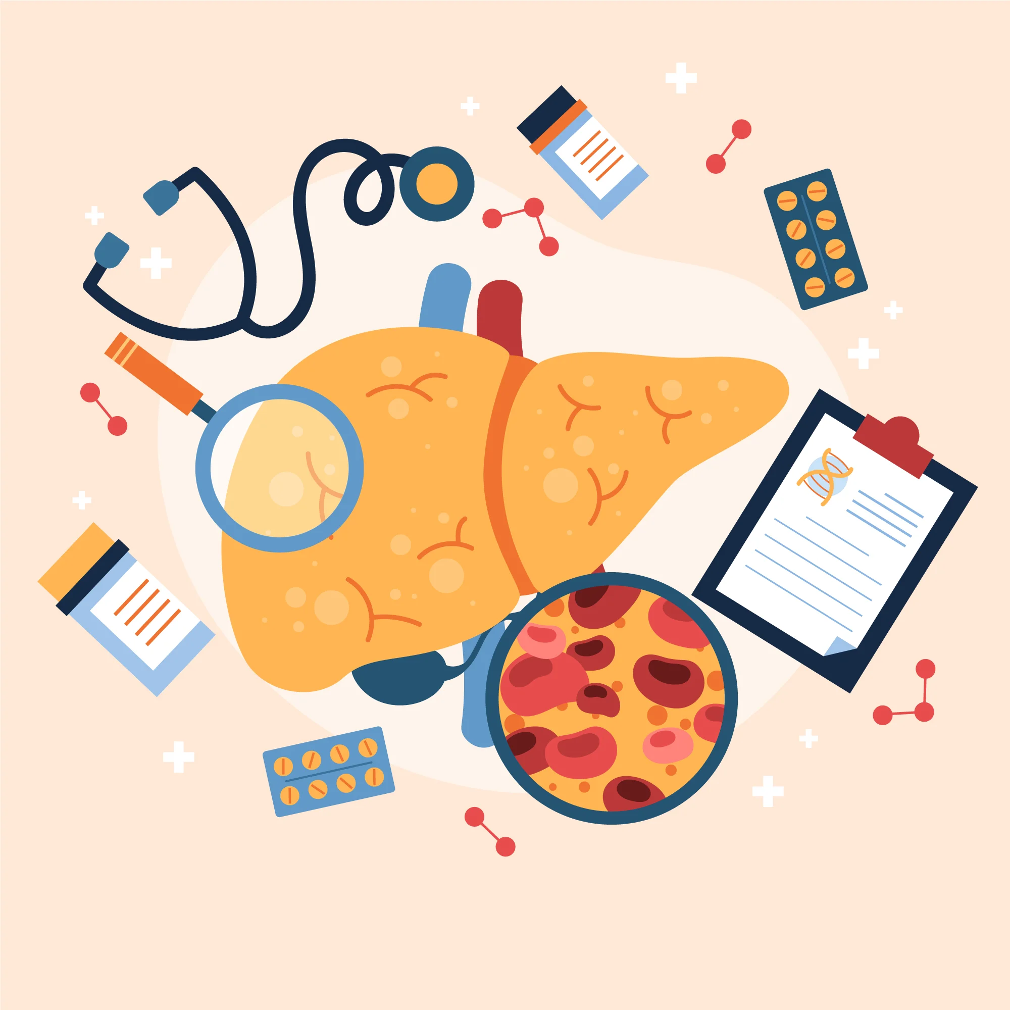 Understanding Fatty Liver Disease: Causes, Mechanisms, and Prevention